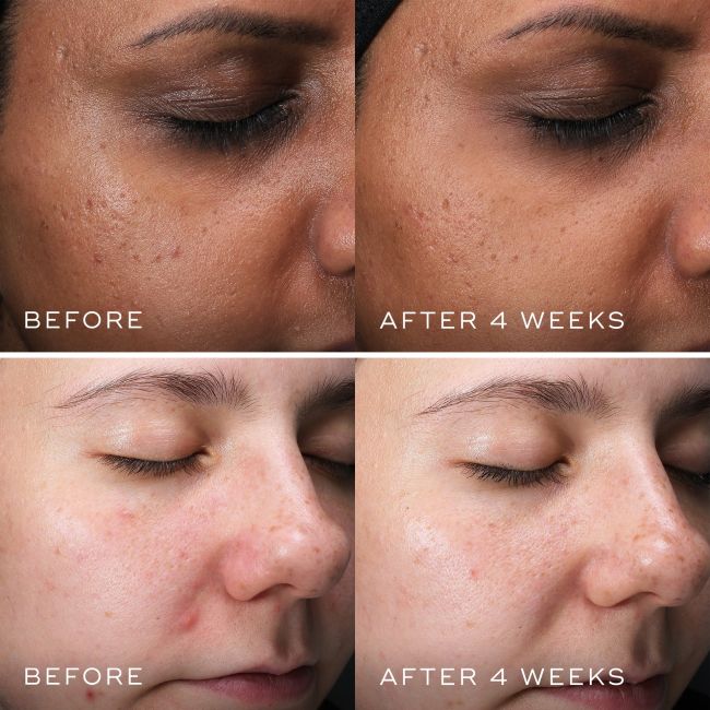 CLARITY PEPTIDES Medik8 – Очищаючі пептиди з ніацинамідом 10%